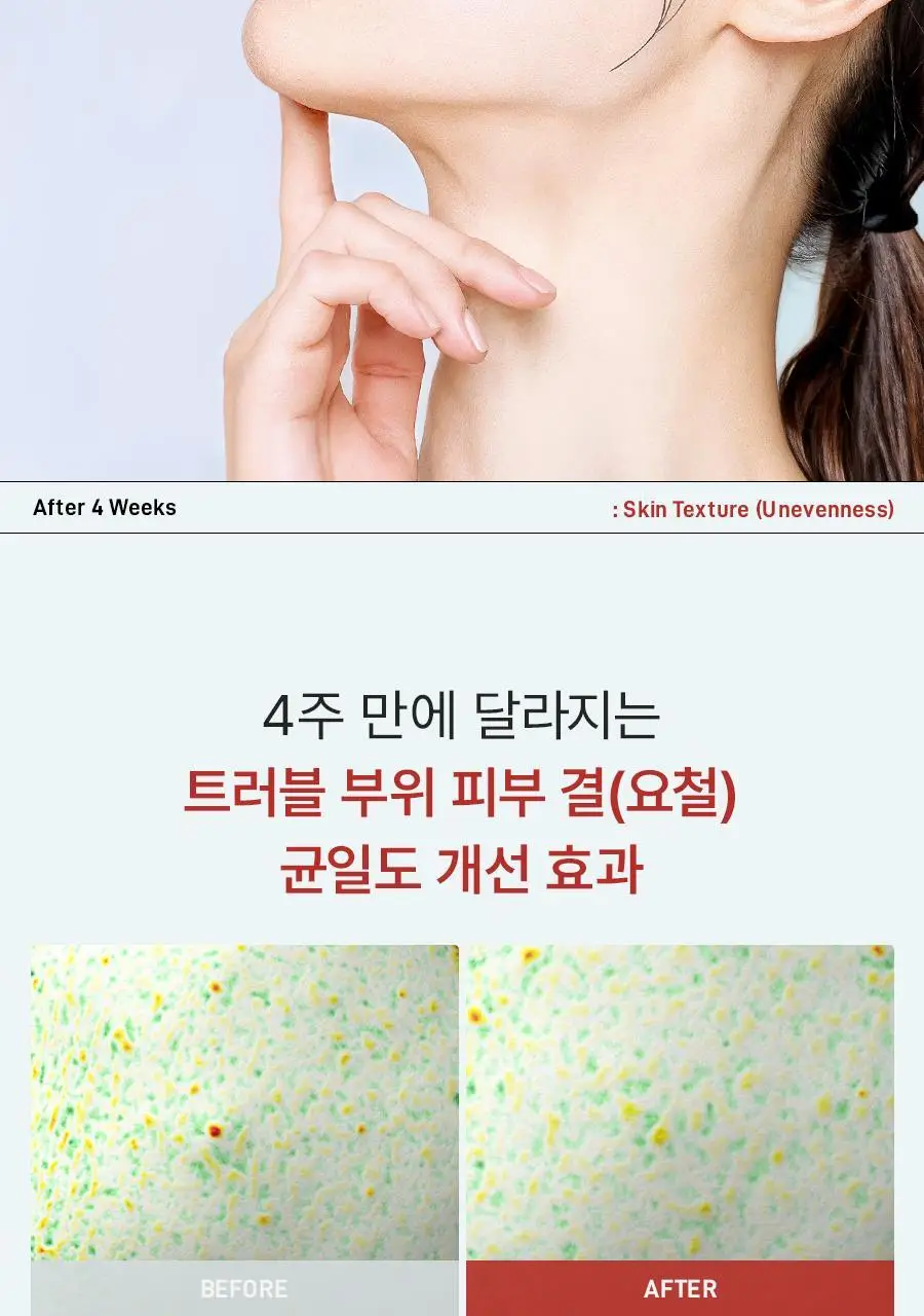 [NEW] 더마젼시 제로카 81 세럼 30ml 상세페이지 22